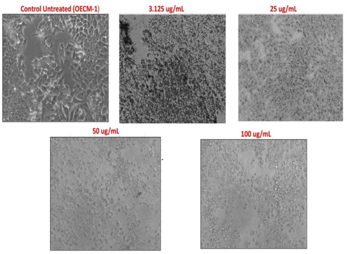 Development & assessment of polyherbal extracts for treating oral cancer by integrating phytochemistry, bioactivities, and network pharmacology