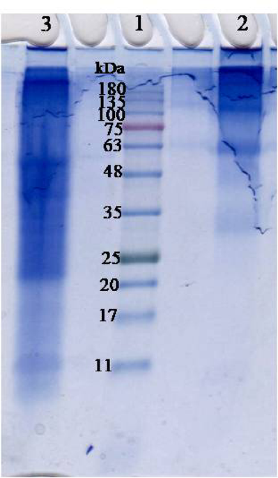Therapeutic potential of crude protein extracts from two Egyptian freshwater snails Lanistes carinatus and Bellamya unicolor