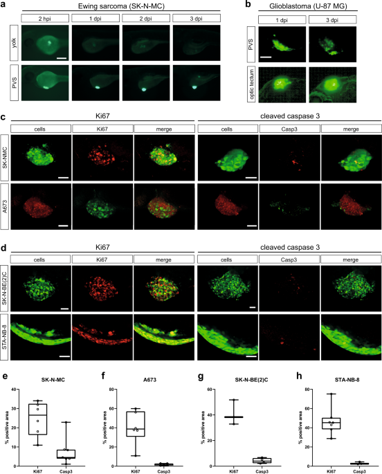 Refined high-content imaging-based phenotypic drug screening in zebrafish xenografts