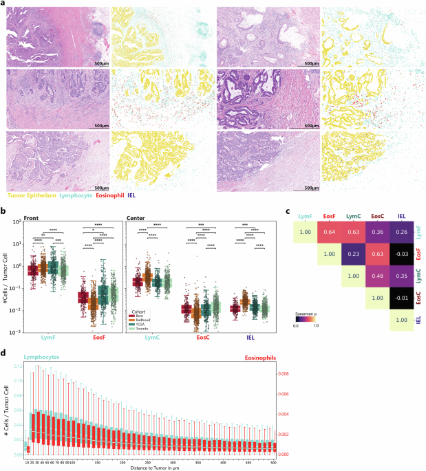 Deep Learning for Enhanced Prognosis: Analyzing Eosinophils and Lymphocytes in Colorectal Cancer