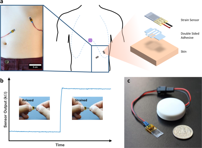 Respiration rate and volume measurements using wearable strain sensors |  npj Digital Medicine