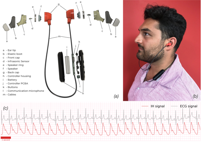 In-ear infrasonic hemodynography with a digital health device for