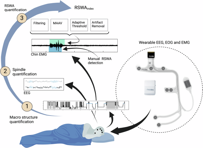 Semi automatic quantification of REM sleep without atonia in natural ...
