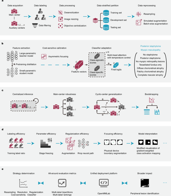 Detecting Pathologic Myopia: A Deep Learning Approach Using Ultra Widefield Imaging