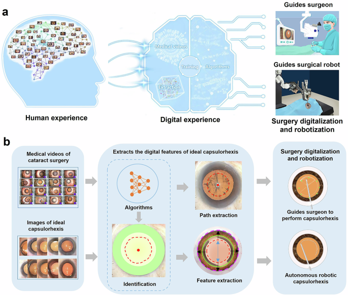 Digitalization of surgical features improves surgical accuracy via surgeon guidance and robotization
