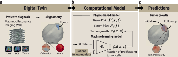 Physics-Informed Machine Learning: A Digital Twin for Modeling Prostate Cancer Growth Using PSA Tests