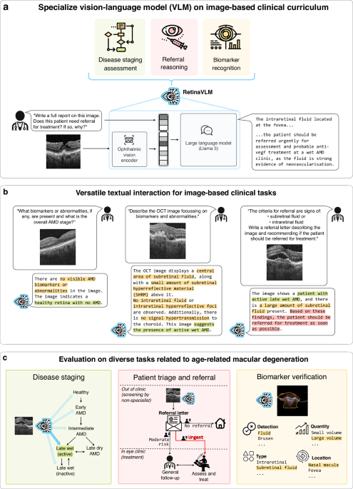 Specialized curricula for training vision language models in retinal image analysis