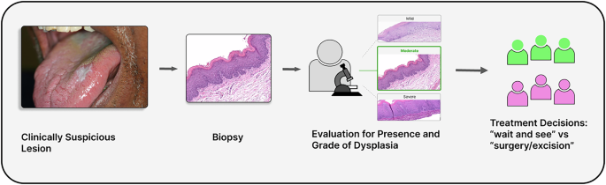 AI-driven prediction of progression to oral squamous cell carcinoma ...