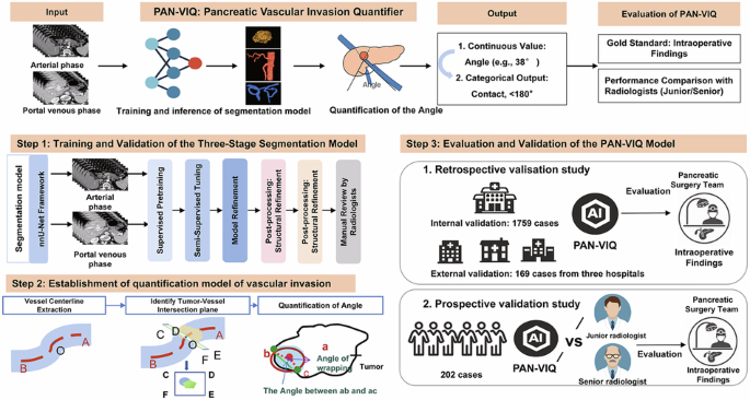 A clinically validated 3D deep learning approach for quantifying vascular invasion in pancreatic cancer