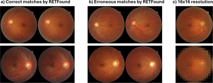 Matters Arising: Near-identical images, not foundation models, explain purported re-identification of patients from medical imaging - npj Digital Medicine