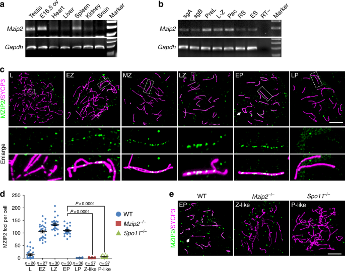 Evolutionarily-conserved mzip2 is essential for crossover formation in mammalian meiosis