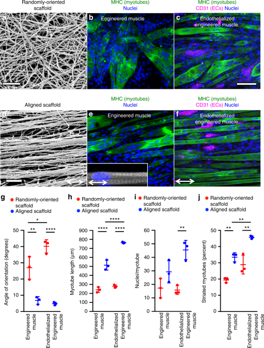 Treatment Of Volumetric Muscle Loss In Mice Using Nanofibrillar Scaffolds Enhances Vascular Organization And Integration Communications Biology