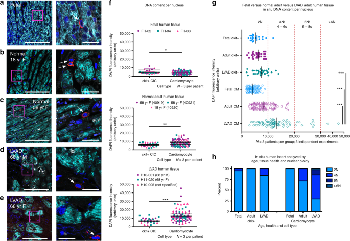 cardiac interstitial tetraploid cells