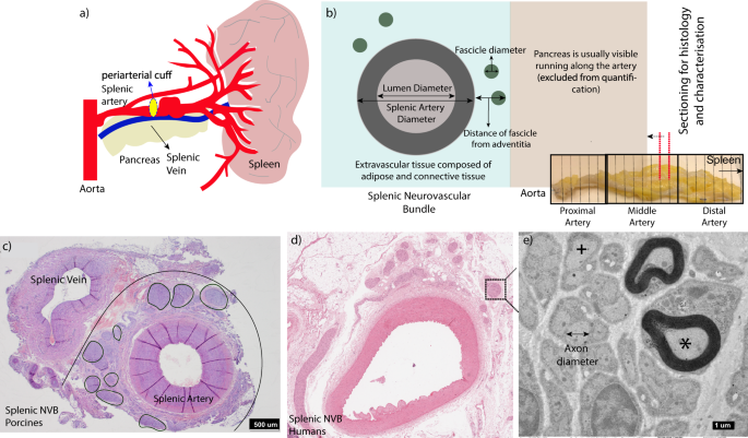 Quantification of clinically applicable stimulation parameters for precision near-organ neuromodulation of human splenic nerves