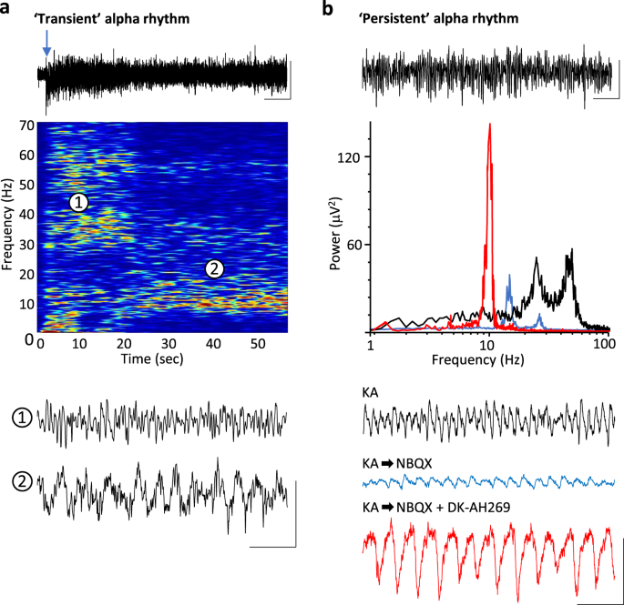 Layer 4 pyramidal neuron dendritic bursting underlies a post-stimulus visual cortical alpha rhythm