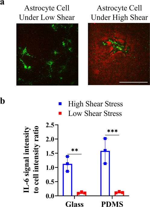 A high-resolution real-time quantification of astrocyte cytokine secretion  under shear stress for investigating hydrocephalus shunt failure