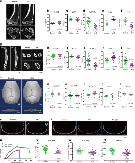 Kindlin-2 mediates mechanotransduction in bone by regulating expression of  Sclerostin in osteocytes | Communications Biology