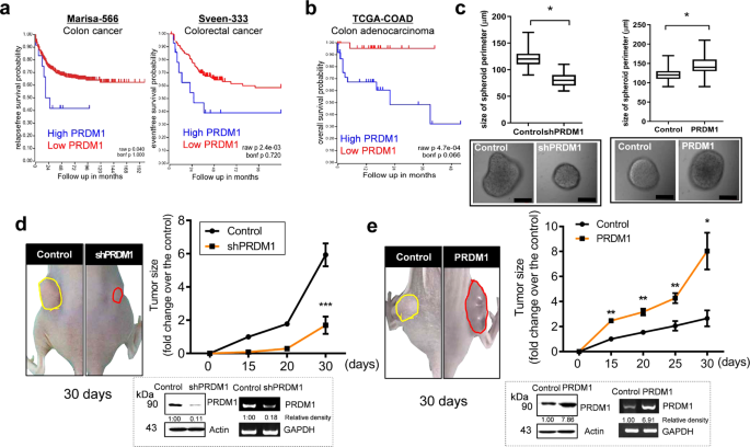 Mucosal Ribosomal Stress Induced Prdm1 Promotes Chemoresistance Via Stemness Regulation Communications Biology Mucosal Ribosomal Stress Induced Prdm1 Promotes Chemoresistance Via Stemness Regulation Communications Biology