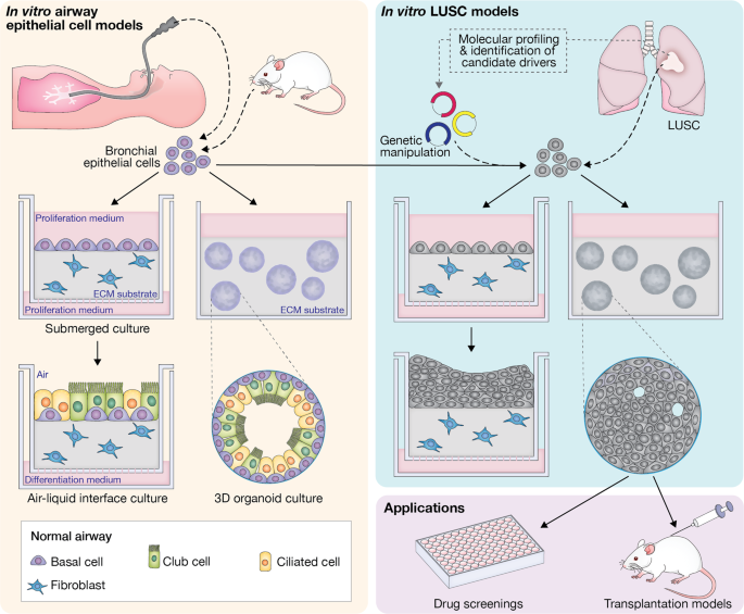 Mapping lung squamous cell carcinoma pathogenesis through in vitro and in  vivo models | Communications Biology