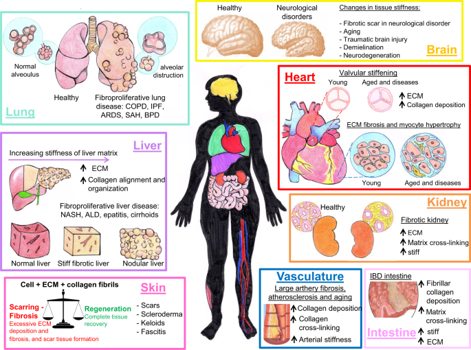 Causal contributors to tissue stiffness and clinical relevance in 