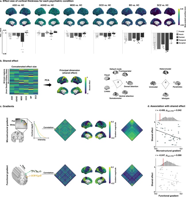Multiscale neural gradients reflect transdiagnostic effects of major psychiatric conditions on corti