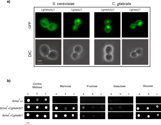 Genomic evolution towards azole resistance in Candida glabrata clinical  isolates unveils the importance of CgHxt4/6/7 in azole accumulation |  Communications Biology