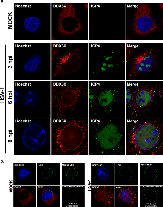 RNA helicase DDX3X modulates herpes simplex virus 1 nuclear egress |  Communications Biology