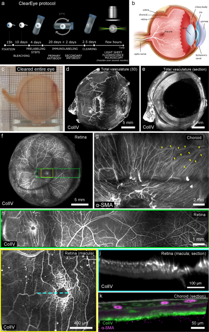 Light sheet fluorescence microscopy of cleared human eyes