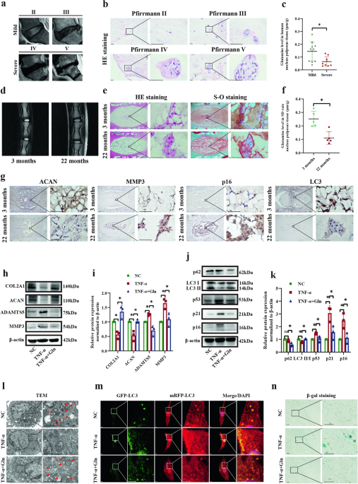 does glutamine increase glutathione l How to Use L-Glutamine for Immunity and Muscle Performance Glutathione and glutamate in schizophrenia Schematics illustrating that glutamine is