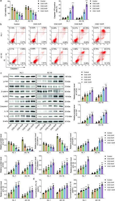Stub1 is acetylated by kat5 and alleviates myocardial ischemia-reperfusion injury through lats2-yap-β-catenin axis