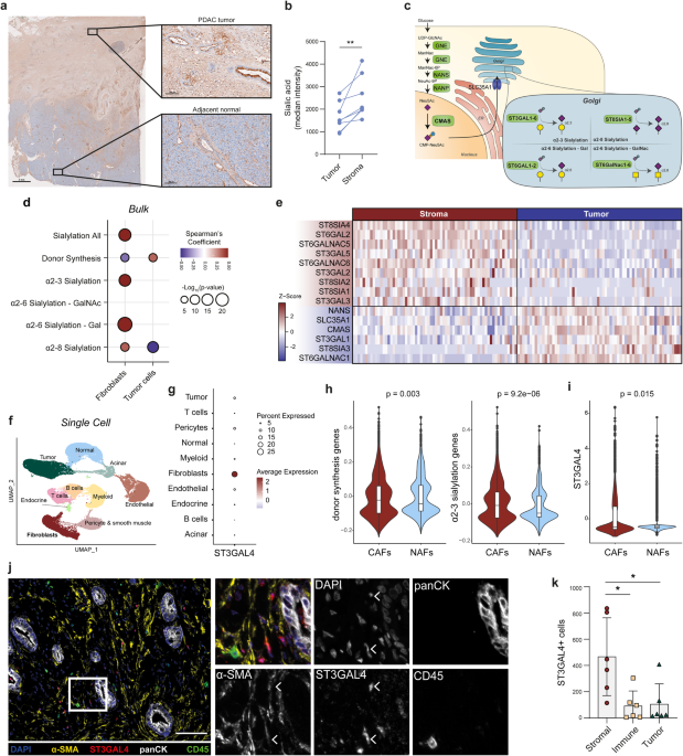 Pancreatic cancer-associated fibroblasts modulate macrophage differentiation via sialic acid-siglec interactions