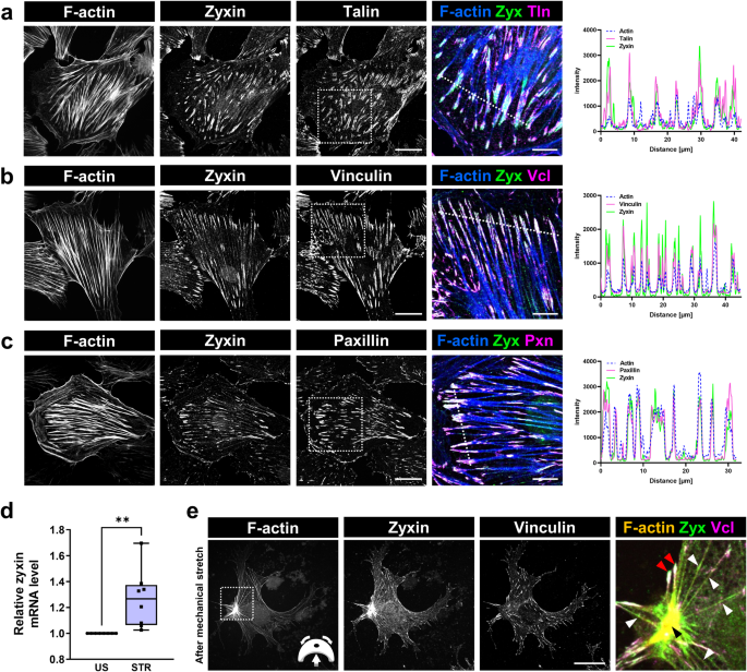 Zyxin is important for the stability and function of podocytes, especially during mechanical stretch