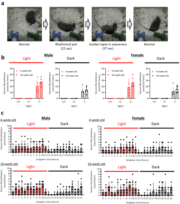 Intranasal oxytocin suppresses seizure-like behaviors in a mouse model of ngly1 deficiency