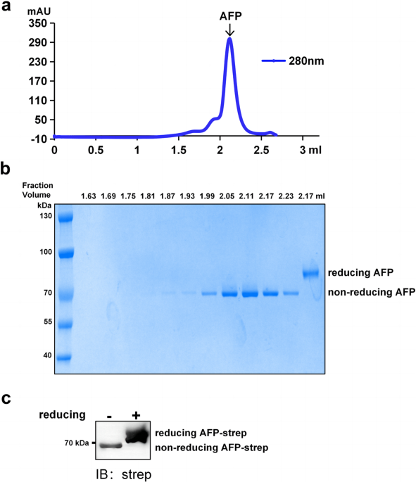 Structural characteristics of alpha-fetoprotein, including n-glycosylation, metal ion and fatty acid binding sites