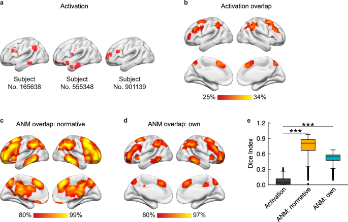 Heterogenous brain activations across individuals localize to a common ...
