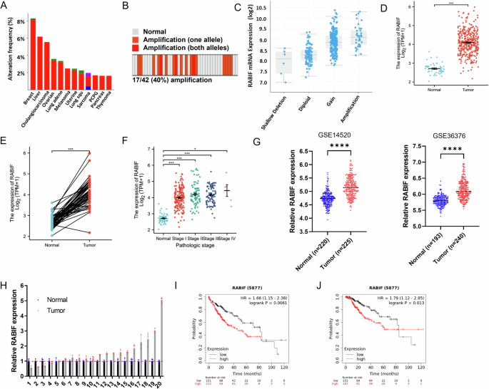 RABIF promotes hepatocellular carcinoma progression through regulation ...