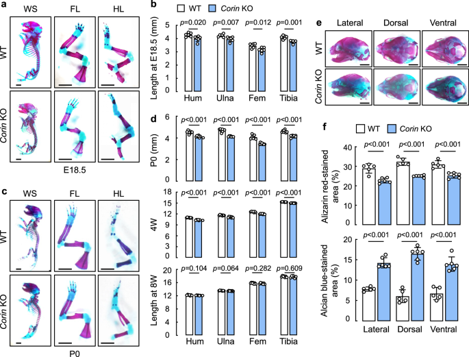 Deficiencies in corin and atrial natriuretic peptide-mediated 