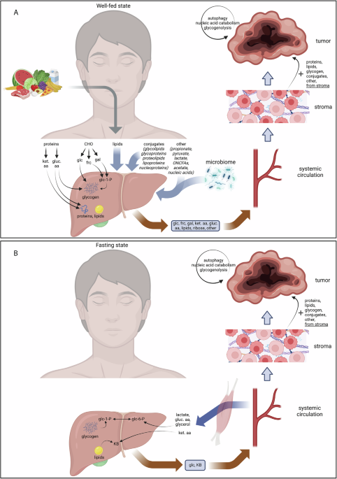 Catabolic rewiring in cancer impacts dietary interventions | Communications  Biology