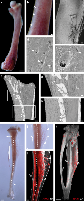 A Network Of Trans Cortical Capillaries As Mainstay For Blood Circulation In Long Bones Nature Metabolism