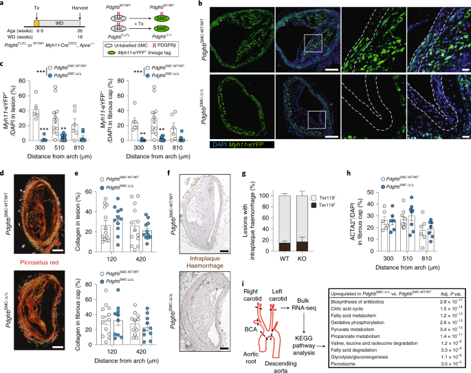 Multiple Cell Types Contribute To The Atherosclerotic Lesion Fibrous Cap By Pdgfrb And Bioenergetic Mechanisms Nature Metabolism Multiple Cell Types Contribute To The Atherosclerotic Lesion Fibrous Cap By Pdgfrb And Bioenergetic Mechanisms Nature Metabolism