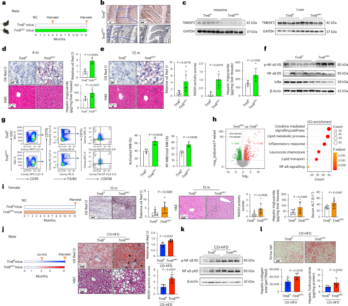 Intestinal TM6SF2 protects against metabolic dysfunction  
