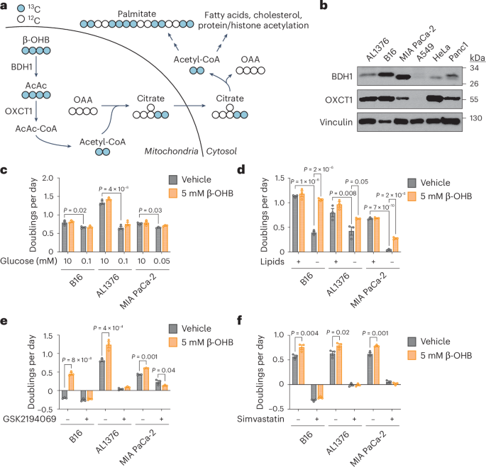 An alternative route for β-hydroxybutyrate metabolism supports cytosolic acetyl-CoA synthesis in cancer cells