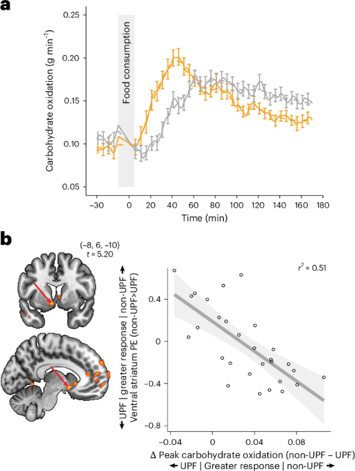 Ultraprocessed foods evoke distinct metabolic and neural responses