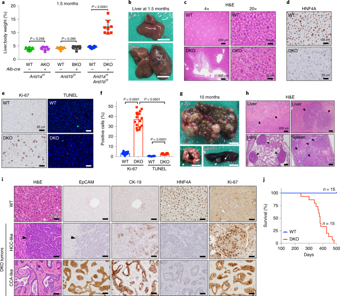 Dual arid1a/arid1b loss leads to rapid carcinogenesis and disruptive redistribution of baf complexes
