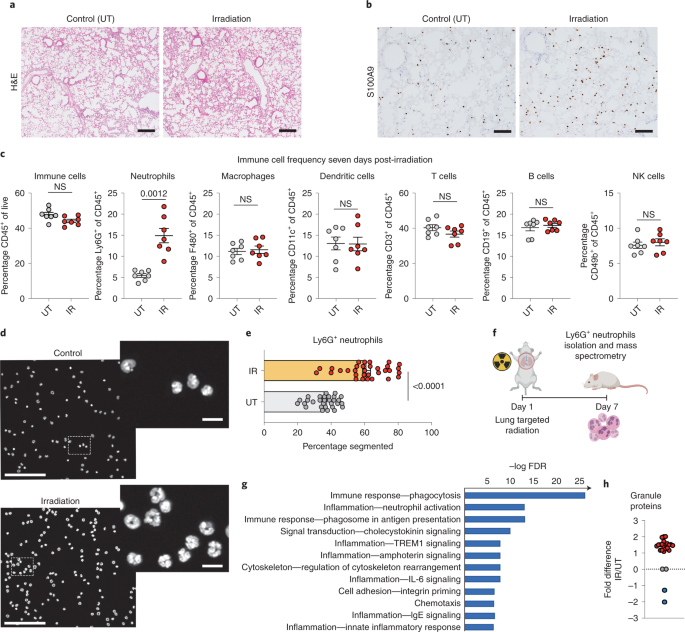 Radiation exposure elicits a neutrophil-driven response in healthy lung  tissue that enhances metastatic colonization | Nature Cancer
