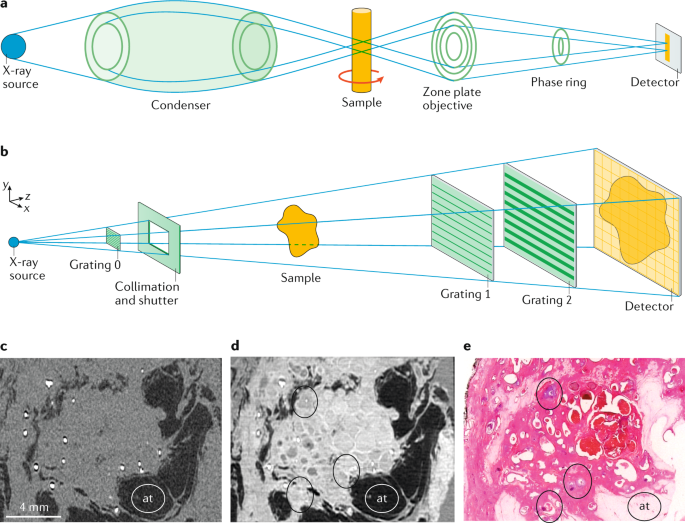 Segmented images of wheat refractions (a) sound grains, (b) damaged