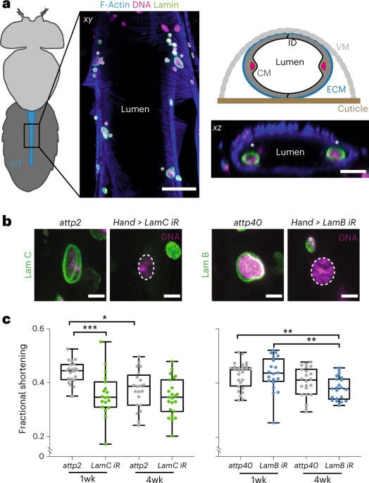 Nuclear remodeling drives age-related cardiac dysfunction