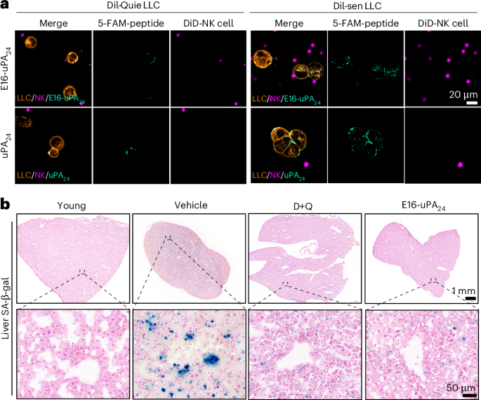 Restoring aging-related tissue homeostasis via reactivated innate immunotherapy
