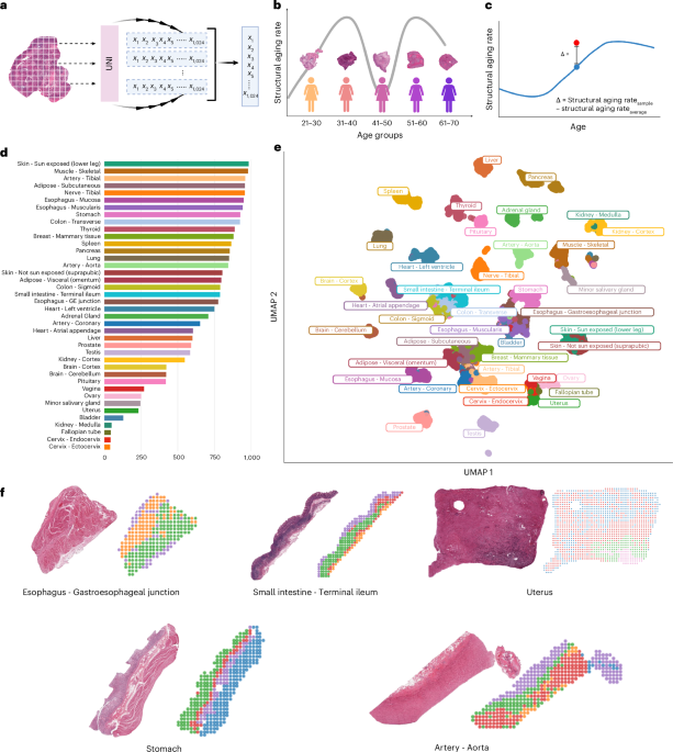 Mapping structural aging across human tissues reveals tissue-specific trajectories and coordinated deterioration - Nature