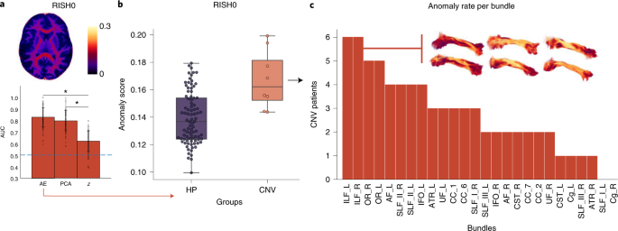 Leveraging Datature Nexus for Tumor and Anomaly Detection in Medical Scans  : Part I